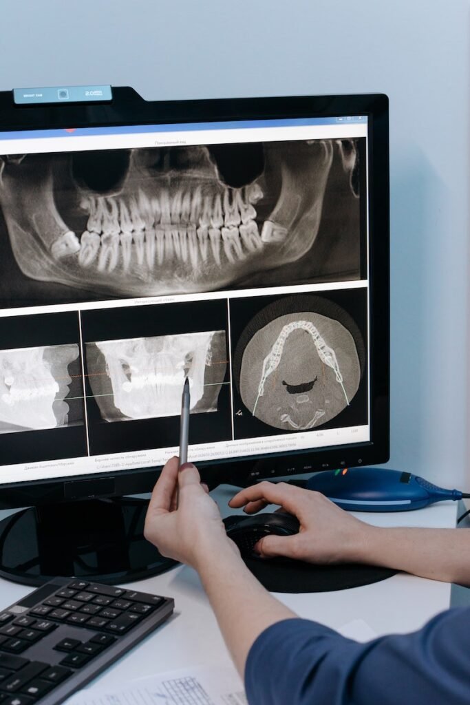 An X-ray Image of a Jawbone in the Computer